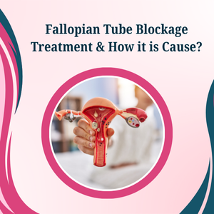 Fallopian Tube Blockage Treatment & How it is Cause?