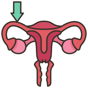 Fallopian Tube